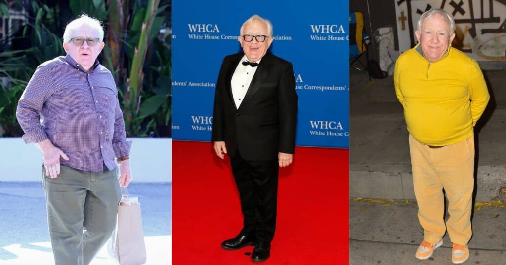 Leslie Jordan Dwarfism, Life and Death of the Legend